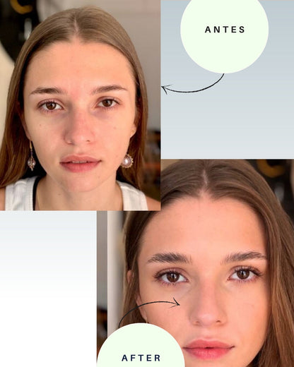 Mascara Facial Led + Sérum de regalo